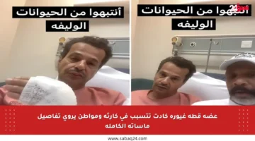 عضة قطة غيورة كادت تتسبب في كارثة ومواطن يروي تفاصيل مأساته الكاملة